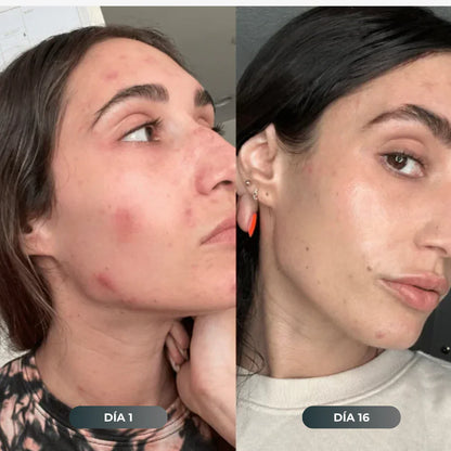 Salva Tu Piel, Tu Pelo y Tu Salud del Desastre con Oasis