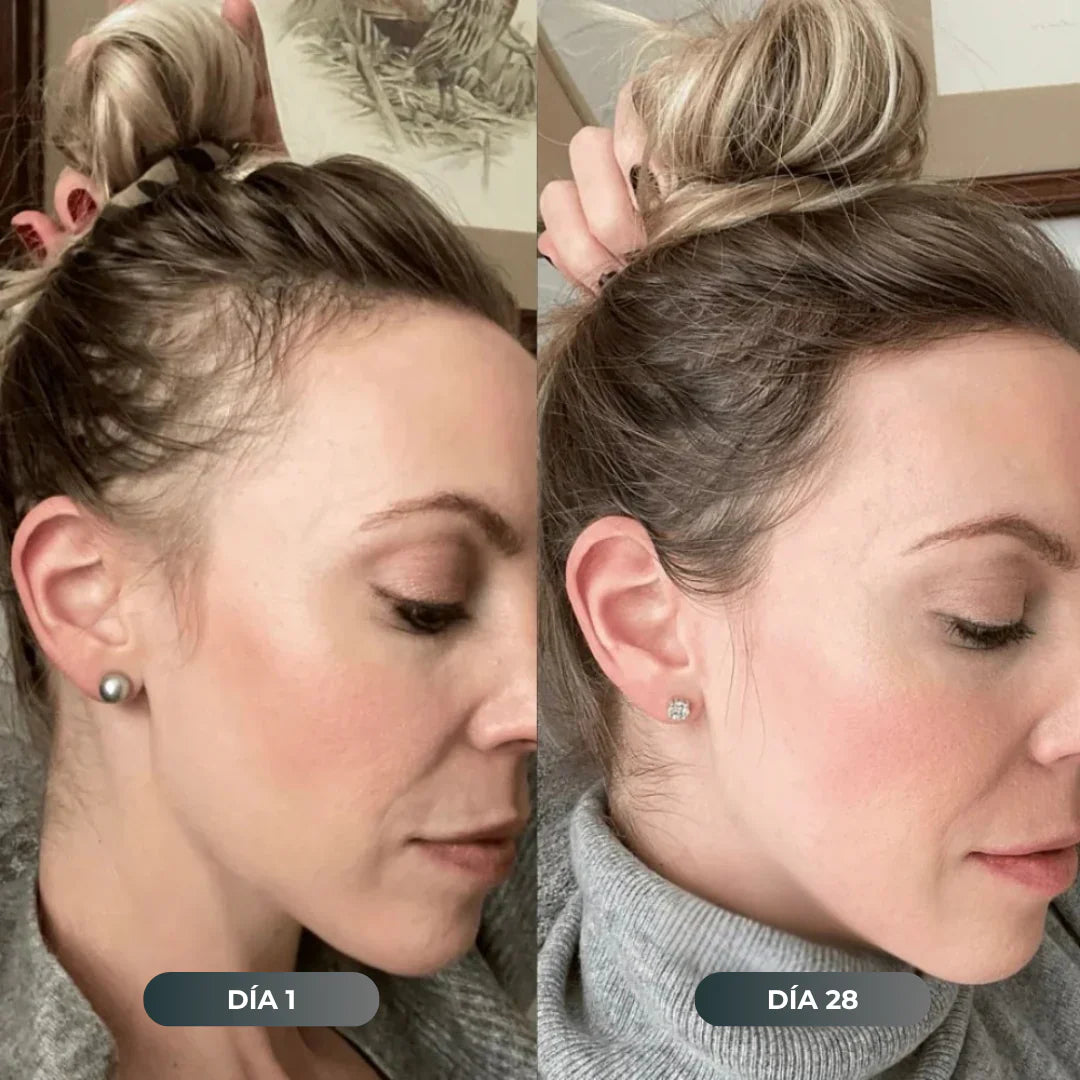 Salva Tu Piel, Tu Pelo y Tu Salud del Desastre con Oasis